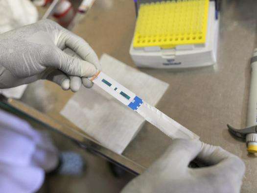 Treating HIV and AIDS in Conakry